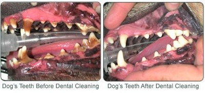 dentalbeforeandafter